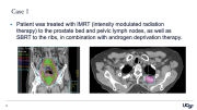 Recurrent Prostate Cancer Cases - Prostate Cancer Patient Conference 2022