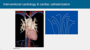 Heart Valves: What Can Go Wrong and the Latest Approaches to Making  Them Right Again