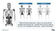 Lu-PSMA Radioligand Therapy - Prostate Cancer Patient Conference 2022