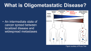 Management of Oligometastatic Prostate Cancer: From Imaging to Therapy - Prostate Cancer Patient Conference 2022