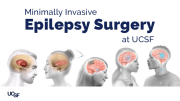 Minimally Invasive Epilepsy Surgery at UCSF